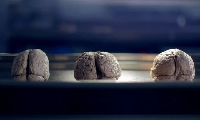 你的大脑是男性还是女性 Horizon - Is your brain male or female?